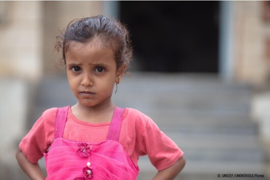 栄養不良の治療を受けている4歳のロワイダちゃん。紛争の影響でイエメンの子どもの栄養状態は悪化している(イエメン、2021年7月撮影) © UNICEF_UN0605553_Remp
