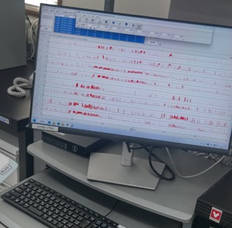 （写真４）貝殻の動きをプロットしたもの